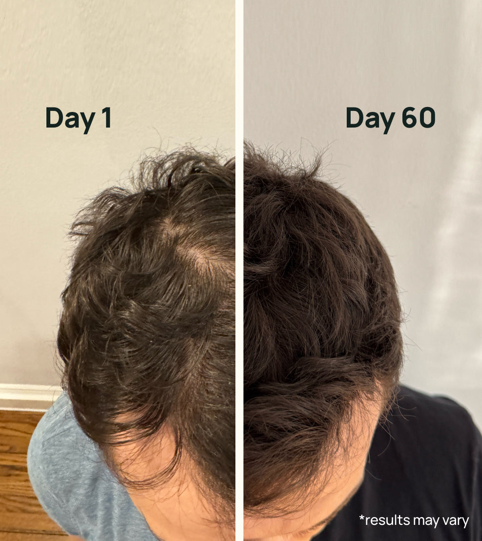 Hair Thickening Formula Normal