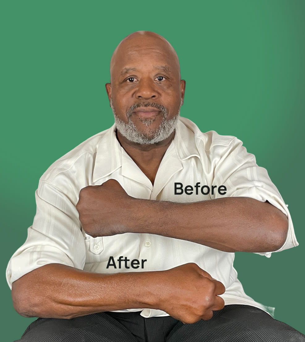 Before Krete serum usage: man with dry skin on his face.